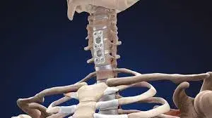 treatment-Image