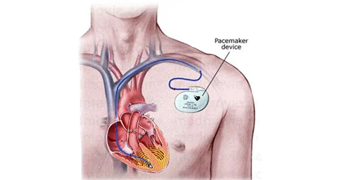 treatment-Image