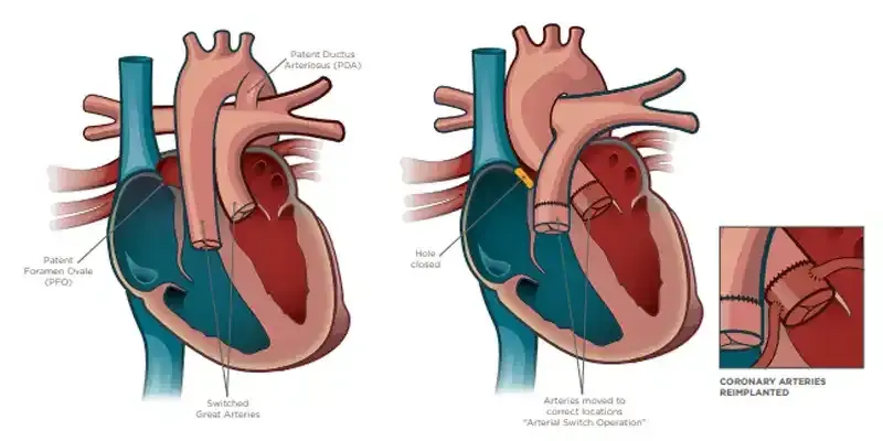 treatment-Image