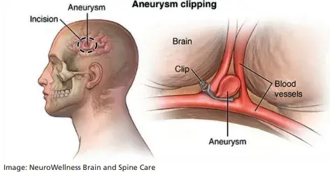 treatment-Image