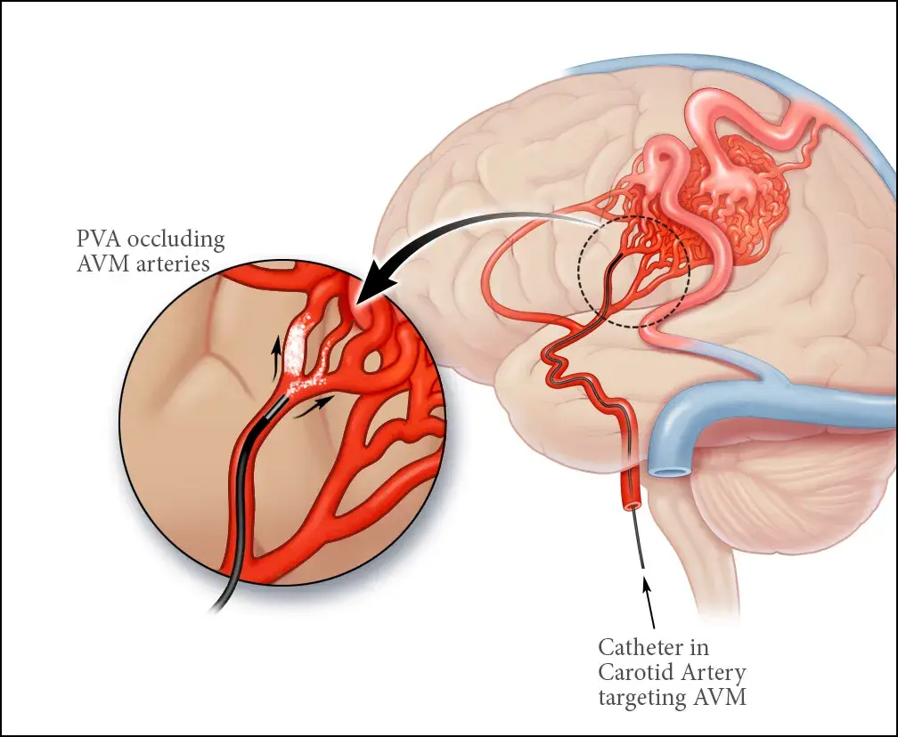 treatment-Image