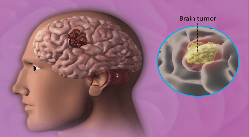 treatment-Image