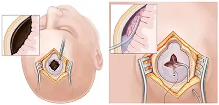 treatment-Image
