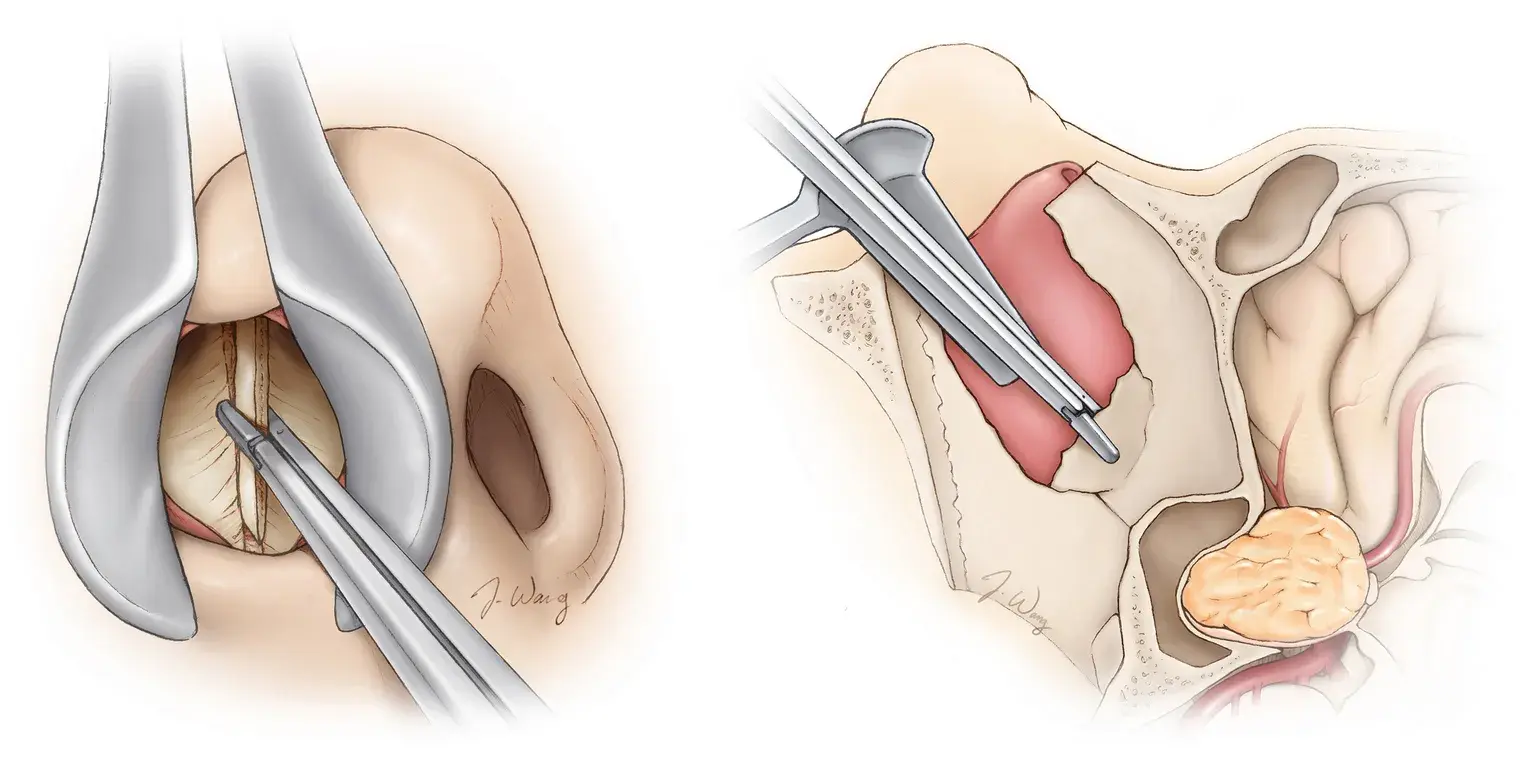treatment-Image