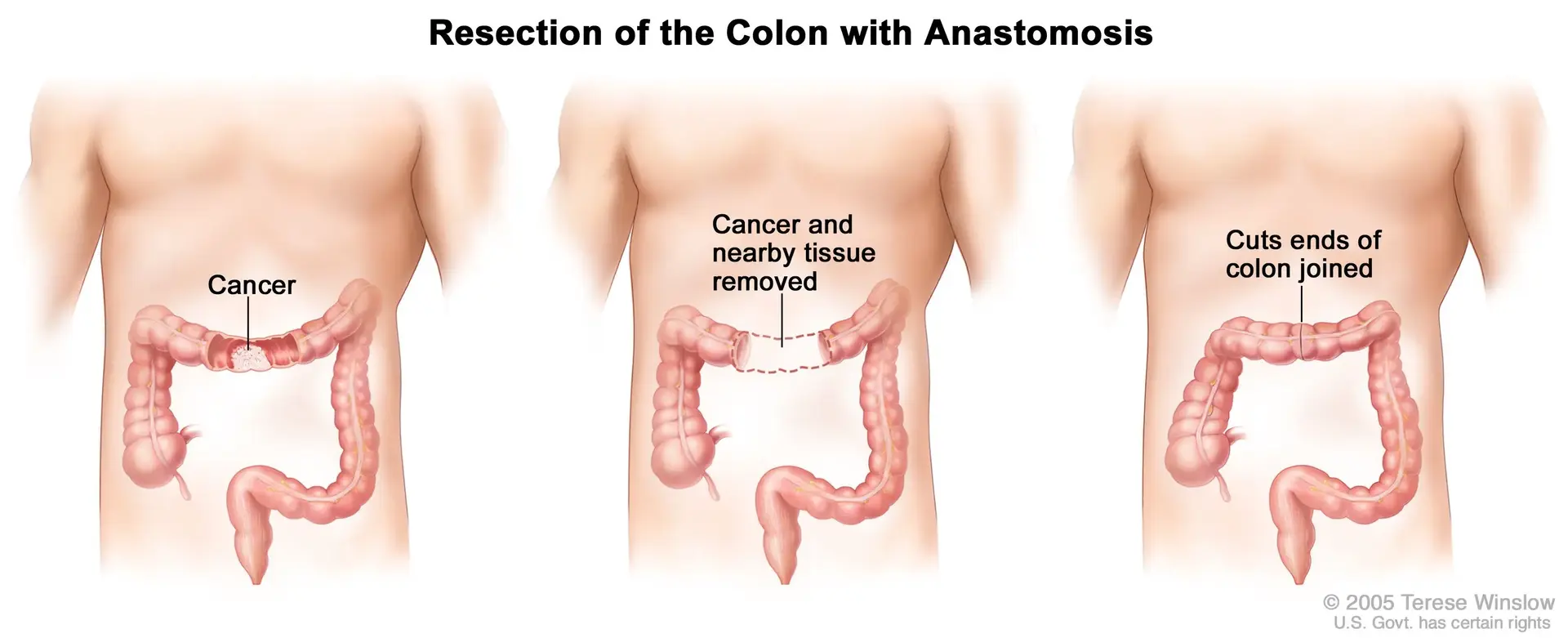 treatment-Image