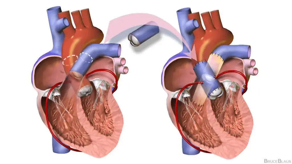 treatment-Image