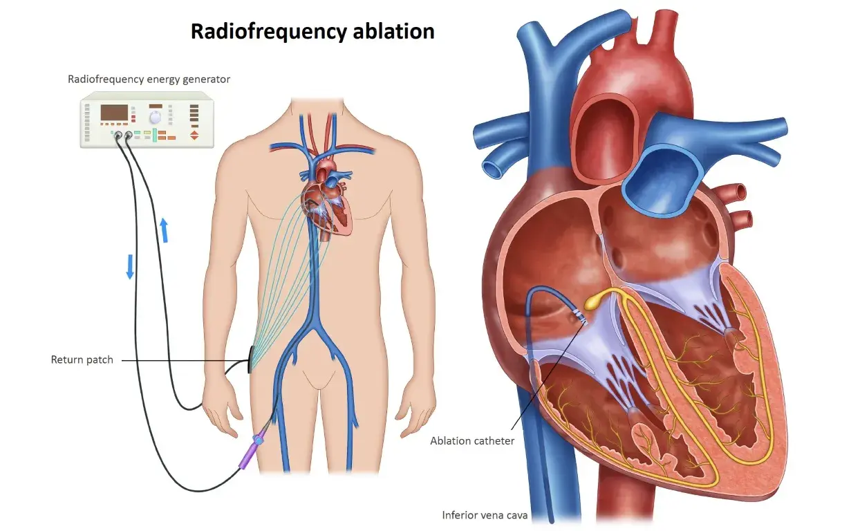 treatment-Image