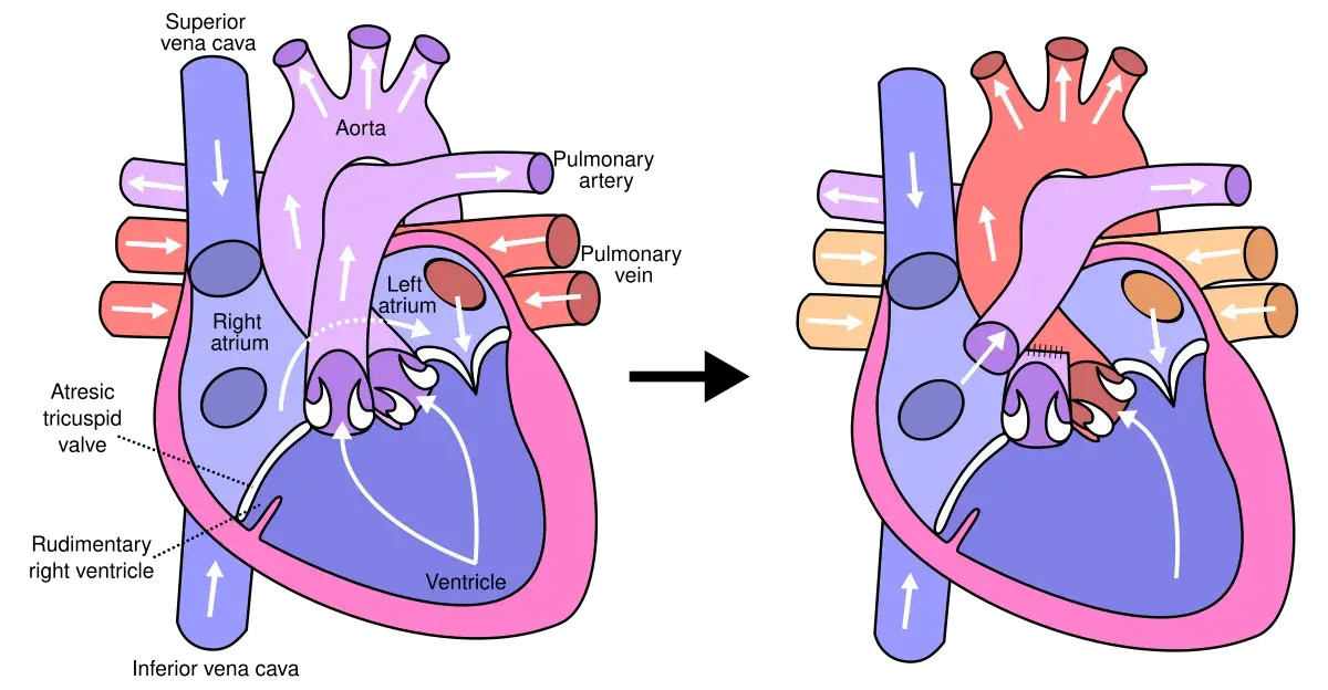 treatment-Image