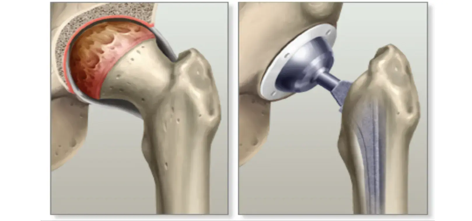 treatment-Image