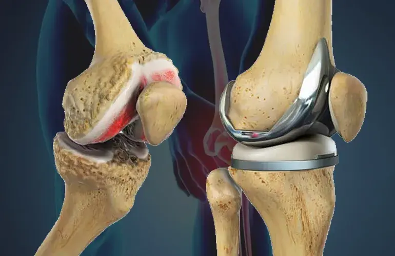 treatment-Image