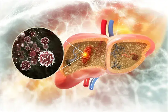 treatment-Image