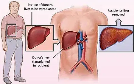 treatment-Image