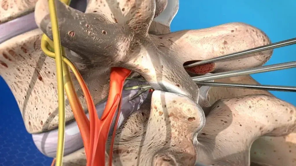 treatment-Image