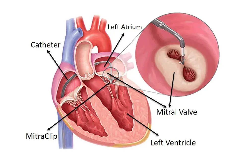 treatment-Image