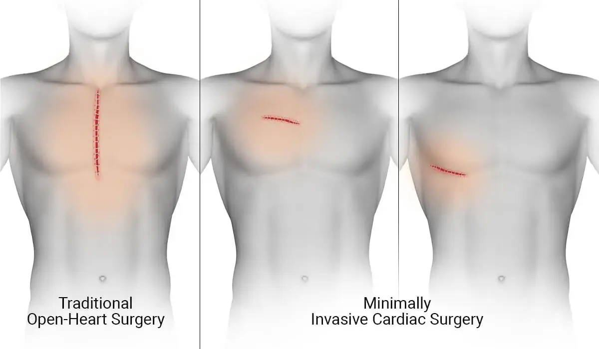 treatment-Image
