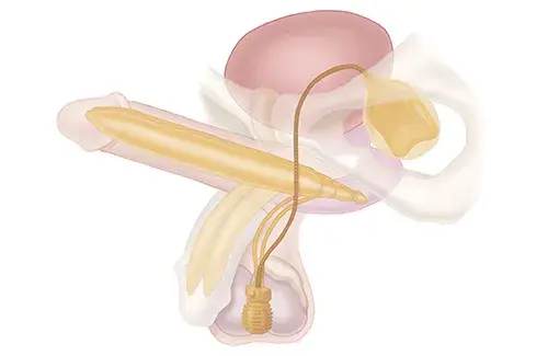 treatment-Image