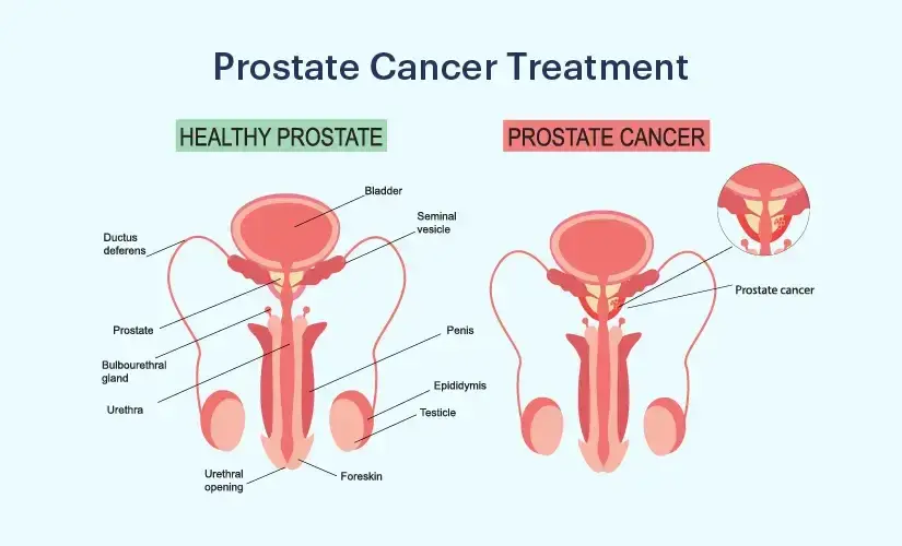 treatment-Image