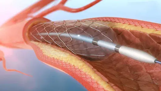 treatment-Image