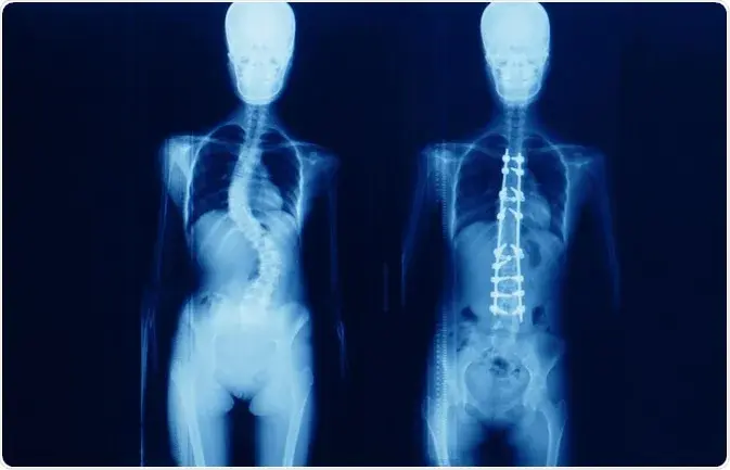 treatment-Image