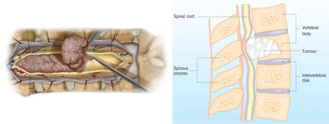 treatment-Image