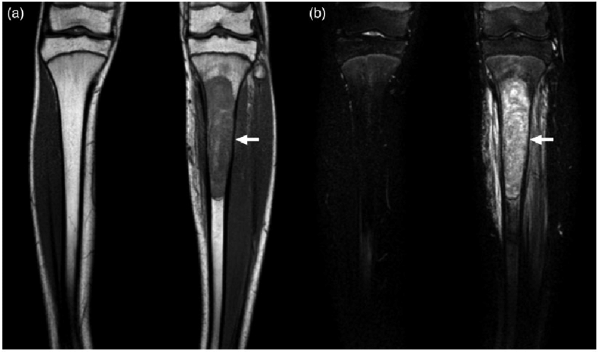 treatment-Image