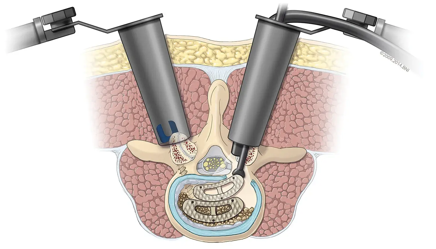 treatment-Image
