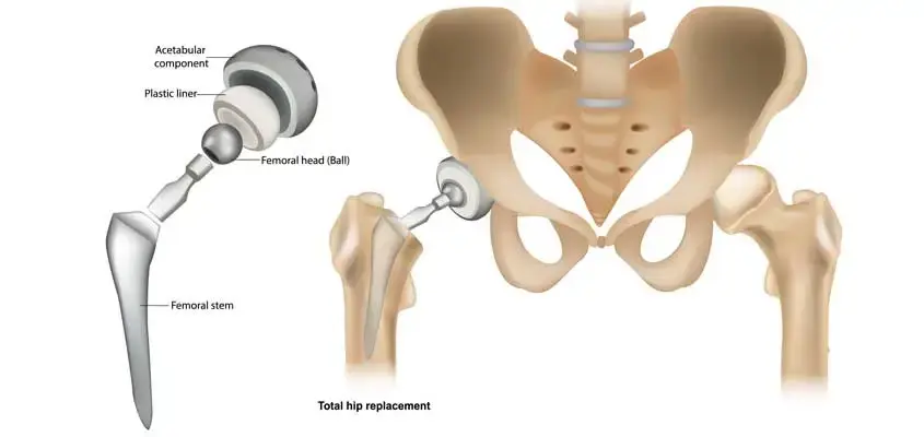 treatment-Image