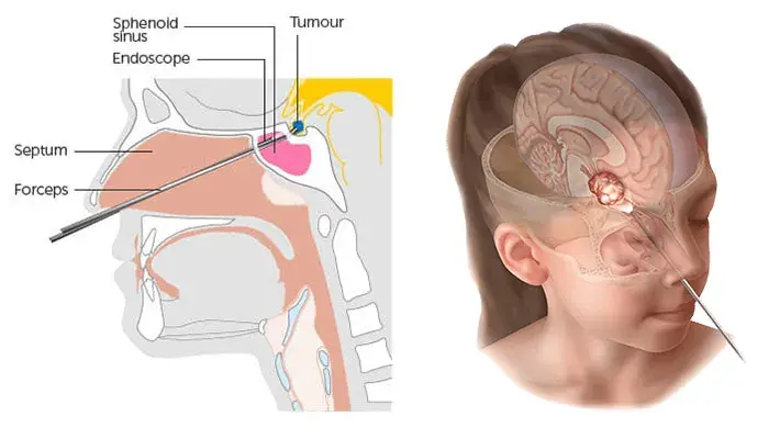 treatment-Image