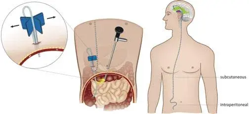 treatment-Image